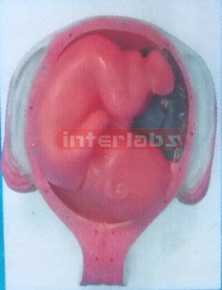 UTERUS WITH EMBRYO (8 MONTH)